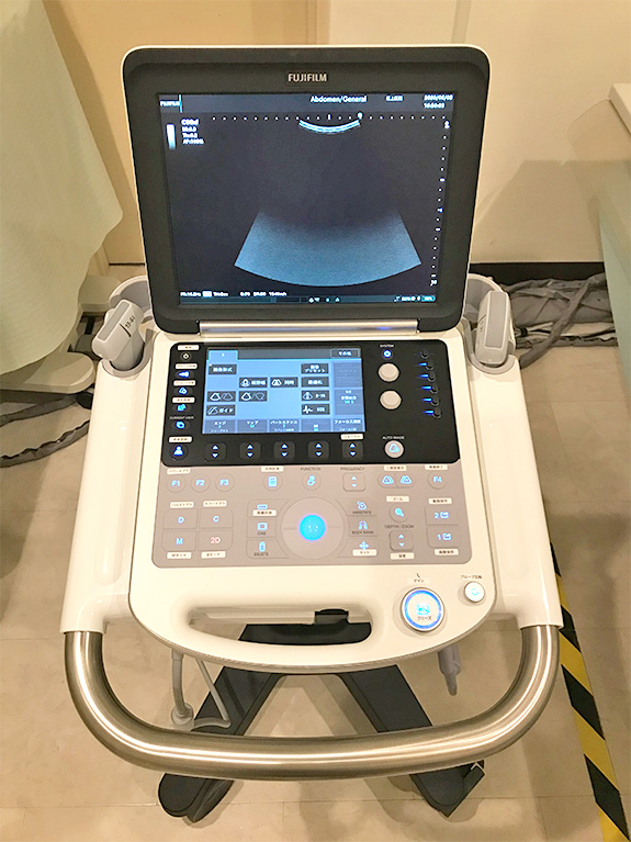 超音波検査機器（腹部・頚部・甲状腺）